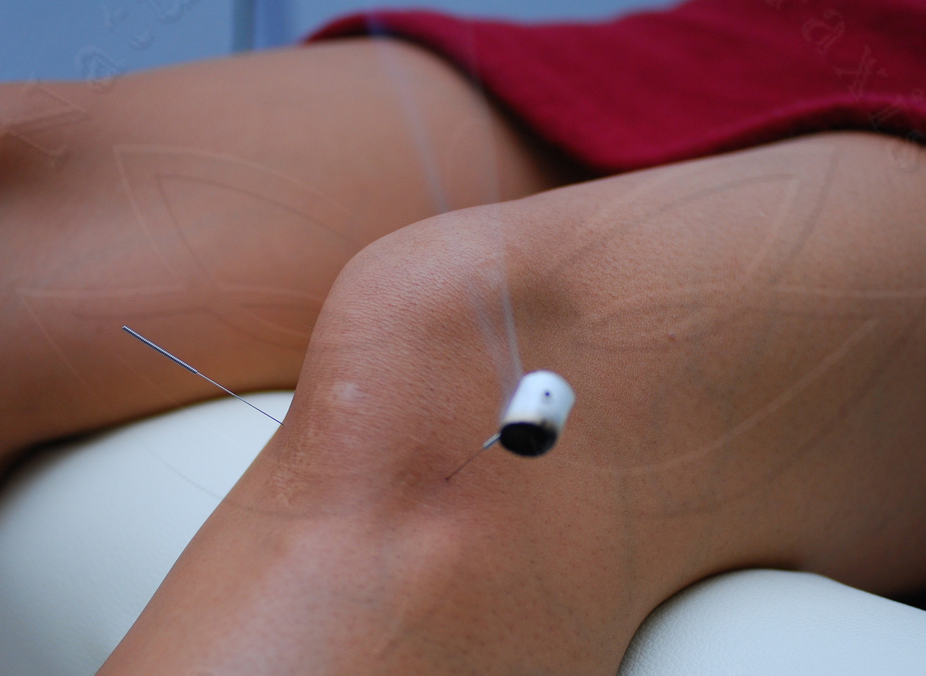 Knie